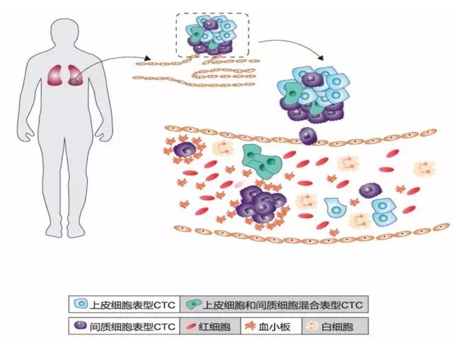CTC循环肿瘤细胞的分类