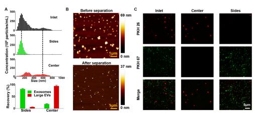 外泌体分离前后的表征