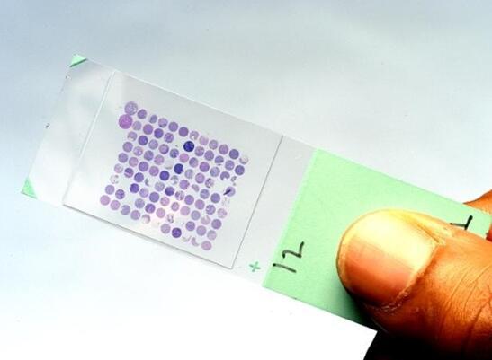 微阵列生物DNA芯片 微阵列生物DNA芯片