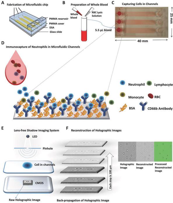 监控血液中嗜中性粒细胞数量的新方法 监控血液中嗜中性粒细胞数量的新方法