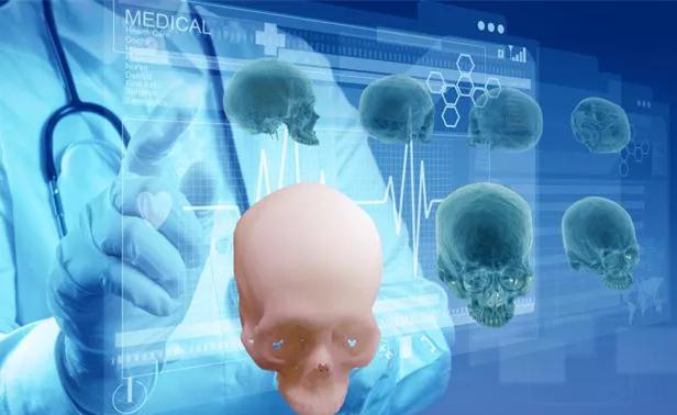 3D打印在面颌修复中的应用