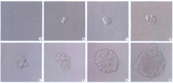 图4 动态观察96孔板培养的单个肿瘤干细胞