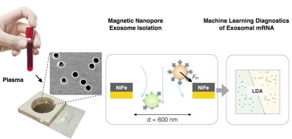 纳米流控技术与机器学习相结合利用外泌体精确诊断胰腺癌