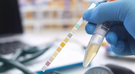 现场快速检测 现场快速检测