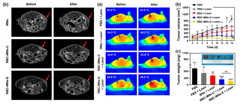 电穿孔包膜技术应用于肿瘤MRI成像与光热治疗