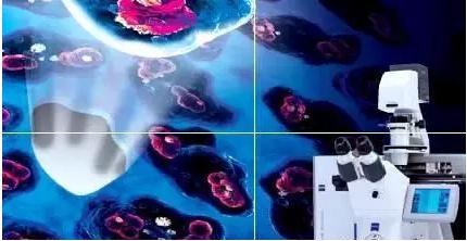 激光显微切割技术（LCM）