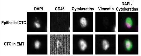 CellSearch 检测CTCs代表性例子的结果示意图