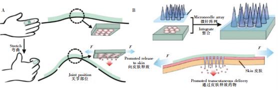 图2可穿戴式微流控药物释放装置。(A)内置药物的可穿戴式微流控芯片,通过手指的弯曲完成药物释放(B)内置药物的可穿戴芯片与微针阵列结合