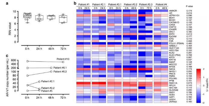 图：从前列腺癌患者血液中分离出的CTC经全血保存后含有完整的RNA，RNA测序和微滴数字PCR结果如图所示。