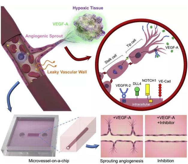 本研究中芯片上VEGF诱导的血管新生的概念图。图片来源：EBioMedicine
