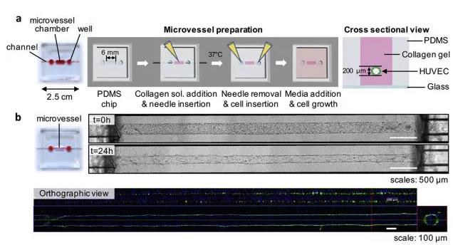利用芯片制备体外人微血管。图片来源：EBioMedicine