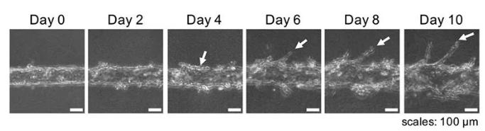 随着时间的推移，可以用显微镜观察到血管的新生。图片来源：EBioMedicine