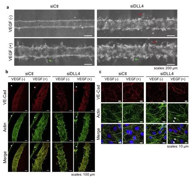 敲除DLL4将影响血管的新生和稳定性。图片来源：EBioMedicine