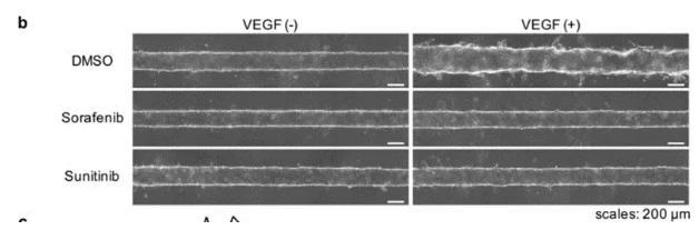 向芯片中添加抗肿瘤药物sorafenib或sunitinib，观察到了血管新生的抑制现象。 图片来源：EBioMedicine