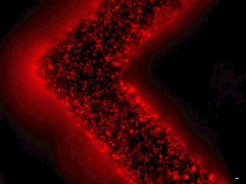 细胞外囊泡（红色）从患者肿瘤细胞中释放并被捕获在EV-HB芯片表面。