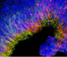 由3D细胞培养产生的新生视网膜 由3D细胞培养产生的新生视网膜