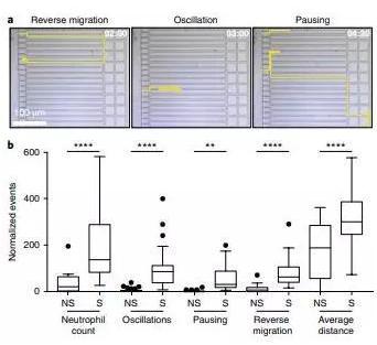 败血症特异性的中性粒细胞自发的迁移模式。