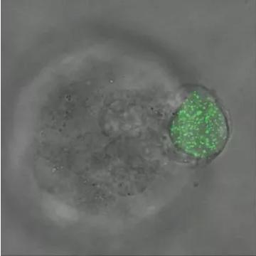 华中科大研发出测量三维生物力的新技术，有望用于癌症早期诊断