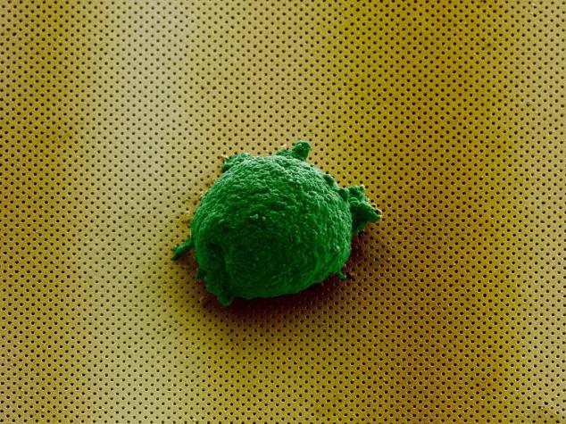 《Small》杂志封面图片显示，单个淋巴瘤细胞孤独地存在于新型生物传感器上。