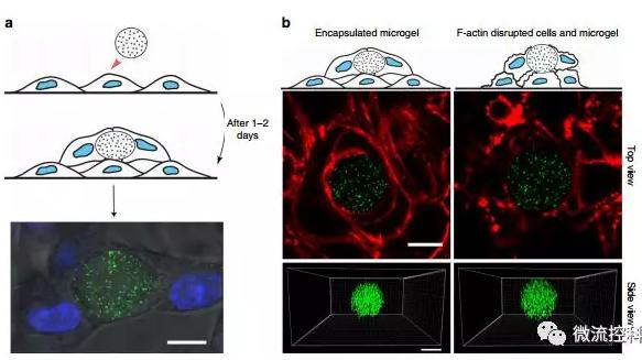 微流控技术开发微型弹性球，可用于癌症诊断