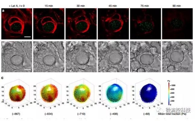 微流控技术开发微型弹性球，可用于癌症诊断