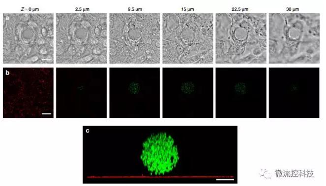 微流控技术开发微型弹性球，可用于癌症诊断