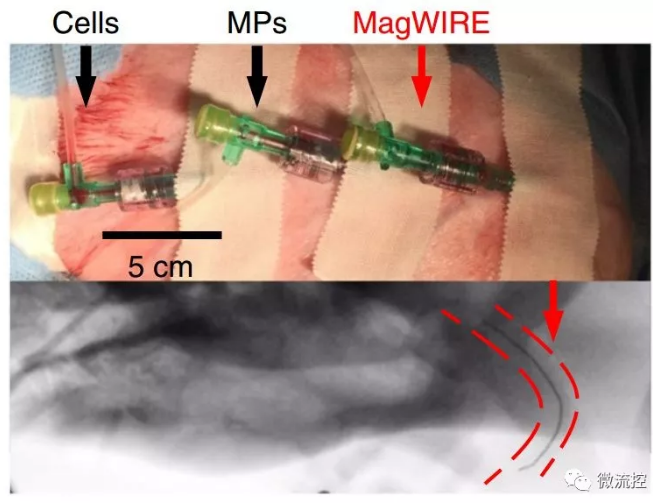 实际装置和造影下的磁线