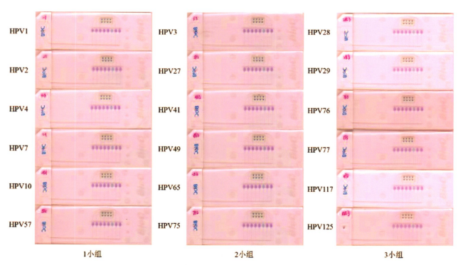 图2皮肤低危型别中3小组组内特异性检测