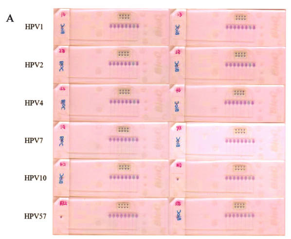 图5皮肤低危型别中3小组组问特异性检测