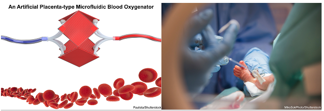 微加工技术解决早产儿肺功能不全的问题不再是梦