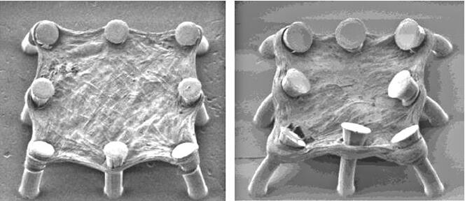 在微柱上培养的肺组织（左）和经过TGF-beta处理后收缩并模拟纤维化的肺组织（右）