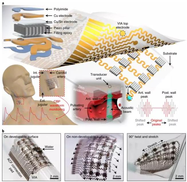 可实时监测体内深处动脉血压的柔性超声波贴片