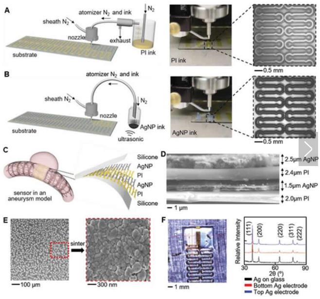 可拉伸的无线传感器可以监测脑动脉瘤的愈合 可拉伸的无线传感器可以监测脑动脉瘤的愈合