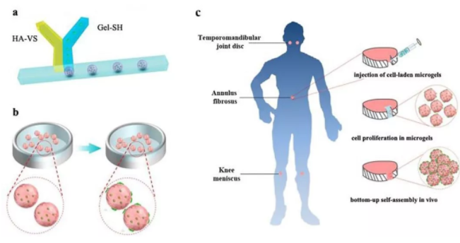 图1：基于干细胞载体Gel-HA微凝胶的软骨修复策略示意图。